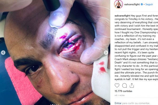 Eddie Álvarez rompe silencio y exhibe ojo desfigurado tras derrota en el ONE; véalo