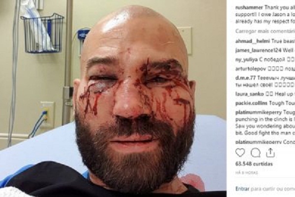 Ex-UFC, amigo de McGregor, se estrena con victoria en el boxeo sin guantes