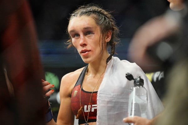 Joanna Jedrzejczyk muestra recuperación de su rostro tras derrota en el UFC 248