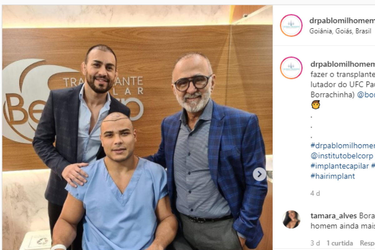 En litigio con la UFC, ‘Borrachinha’ se somete a una cirugía de trasplante de cabello