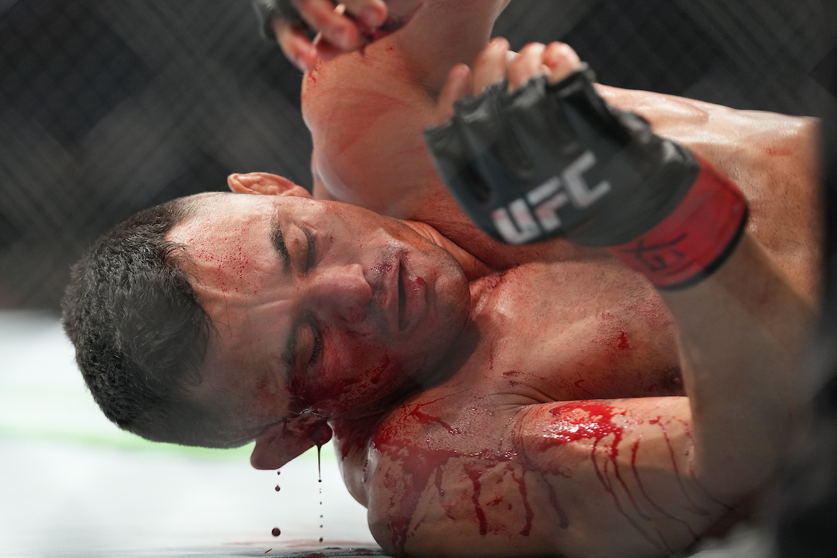 Tras victoria en UFC 271, Douglas D’Silva recibe puntos de sutura por corte en la ceja