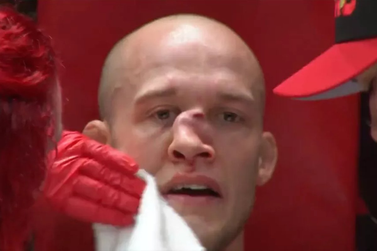 Luchador se rompe la nariz de forma aterradora en evento de Urijah Faber