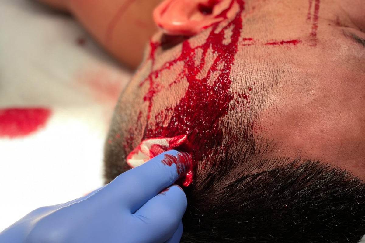 ¡Susto! Luchador sufre corte de arteria en UFC Las Vegas 66