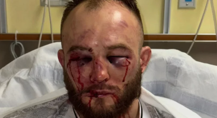 UFC St. Louis: Mateusz Rebecki recibe gancho médico por tiempo indefinido