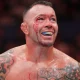 colby-covington-ufc-tampa-machucado